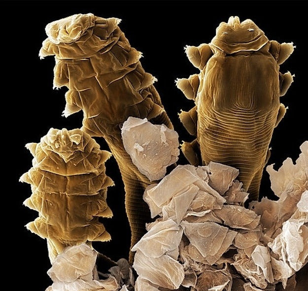demodex follicurum